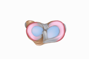 膝関節の半月板（内側半月板・外側半月板）の位置を示した図